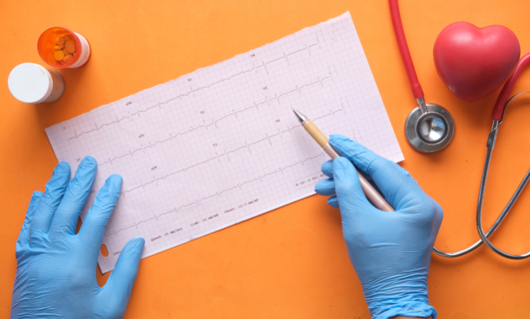 holter EKG